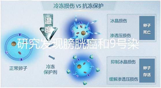 研究發(fā)現(xiàn)膀胱癌和9號染色體缺失有關系！