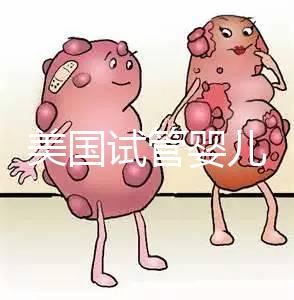 美國(guó)試管嬰兒