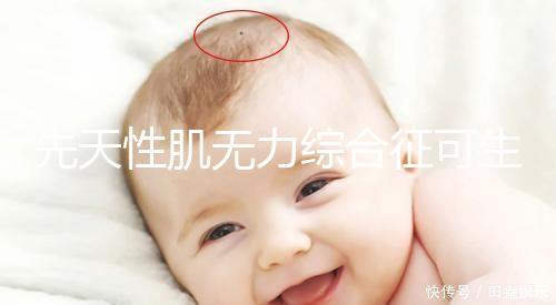 先天性肌無(wú)力綜合征可生育嗎?能做試管避免遺傳?