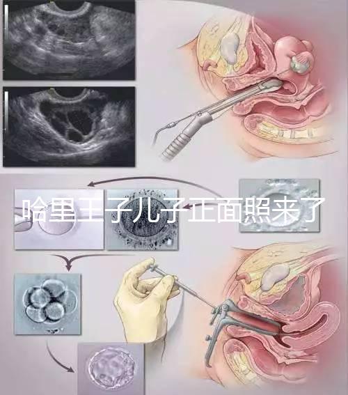 哈里王子兒子正面照來(lái)了，梅根評(píng)價(jià)：氣質(zhì)甜美，乖巧