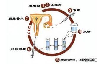 代試管嬰兒和第二代試管嬰兒的區別，基因篩查技術！