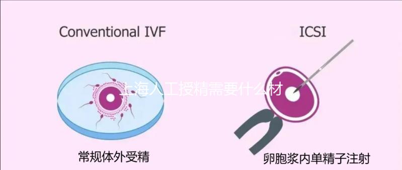 上海人工授精需要什么材料和手續(xù)戳，提前做好準備很重要