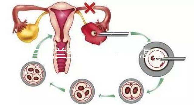 烏克蘭生的小孩回來怎么上戶口一文說清,含落戶政策