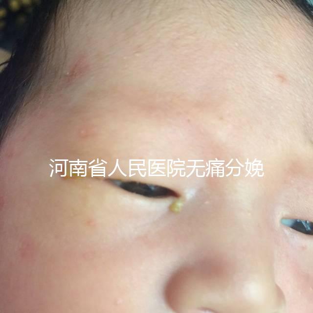 河南省人民醫(yī)院無痛分娩多少錢戳，收費標準60s看懂不踩坑