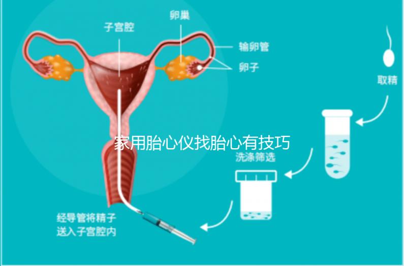 家用胎心儀找胎心有技巧，飯后半個(gè)小時(shí)測(cè)準(zhǔn)確率稍高
