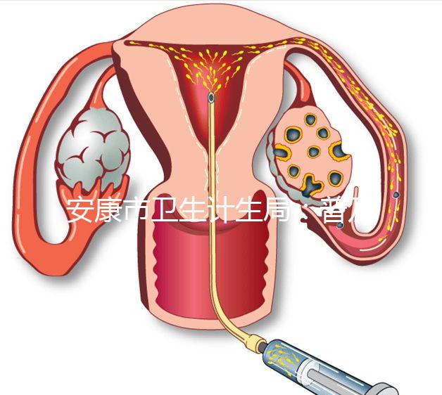 安康市衛生計生局:普及優生優育五項檢查相關知識