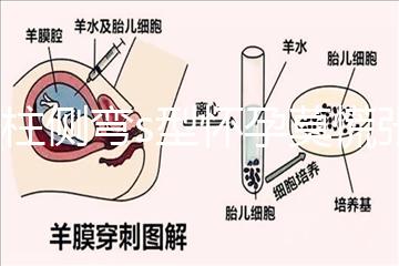 脊柱側彎s型懷孕莫慌張，能否順產還得看這4大要素