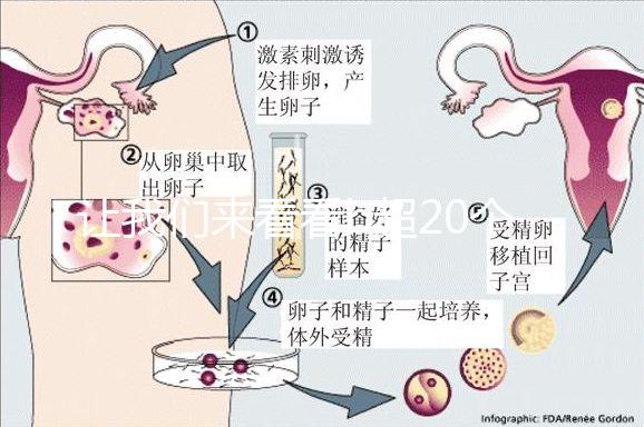 讓我們來(lái)看看b超20個(gè)卵子取10個(gè)是不正常的我們?cè)撛趺崔k?