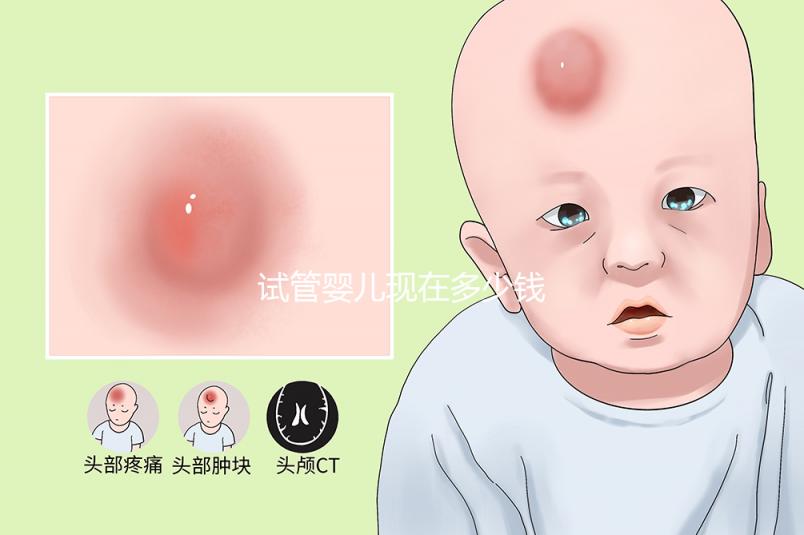 試管嬰兒現(xiàn)在多少錢(qián)