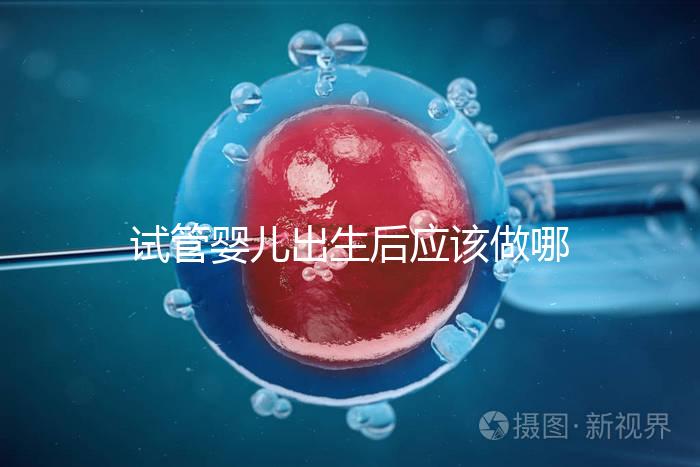 試管嬰兒出生后應(yīng)該做哪些檢查答案？DR應(yīng)該看情況嗎？