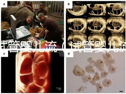 試管嬰兒流(試管嬰兒流程步驟與時間)