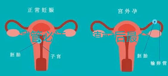 試管必讀,移植前后最全注意事項(xiàng)?