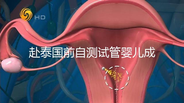 赴泰國前自測試管嬰兒成功率，這些方法值得收藏