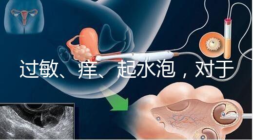 過敏、癢、起水泡，對(duì)于三伏貼的副作用你需知道該怎么辦