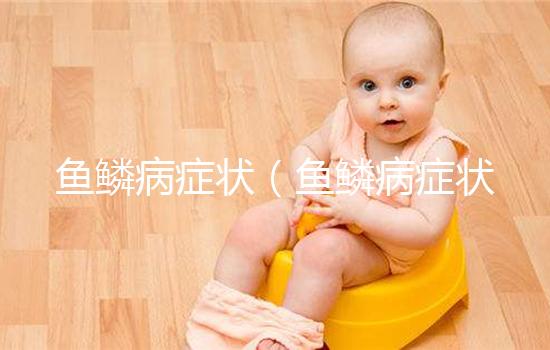 魚鱗病癥狀（魚鱗病癥狀及表現(xiàn)）