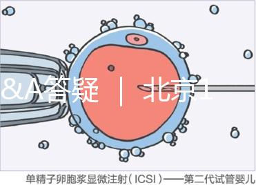 Q&A答疑 | 北京16項輔助生殖技術進醫(yī)保,試管可以報銷嗎?